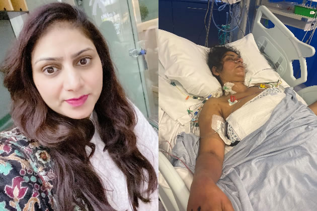 Rajdeep Kaur before and after the collision